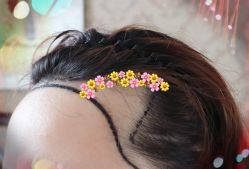 -大麦微针植发全国连锁