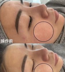 点击看大图 -SKIN79皮肤管理中心