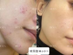 -LUNA皮相美·骨相美高级美感