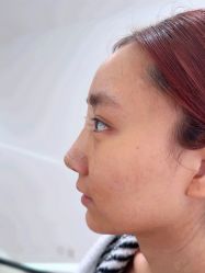 体验后-杭州美莱医疗美容医院