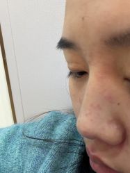 -青岛诺德医学美容医院
