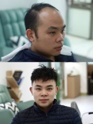 -发饰美男士增发补发假发定制店