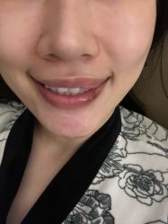 -上海玫瑰医疗美容医院