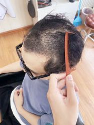 -发饰美男士增发补发假发定制店