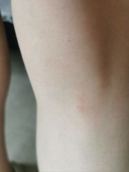 -SKIN79皮肤管理中心