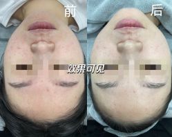 点击看大图 -SKIN79皮肤管理中心