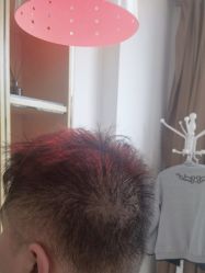-雍禾植发