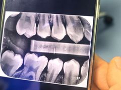 -极橙儿童齿科矫正中心(奥城店)