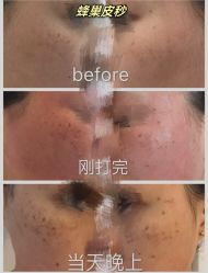 -上海漾颜医疗美容