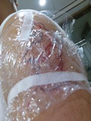 -V一刺青·纹身   穿孔    清洗