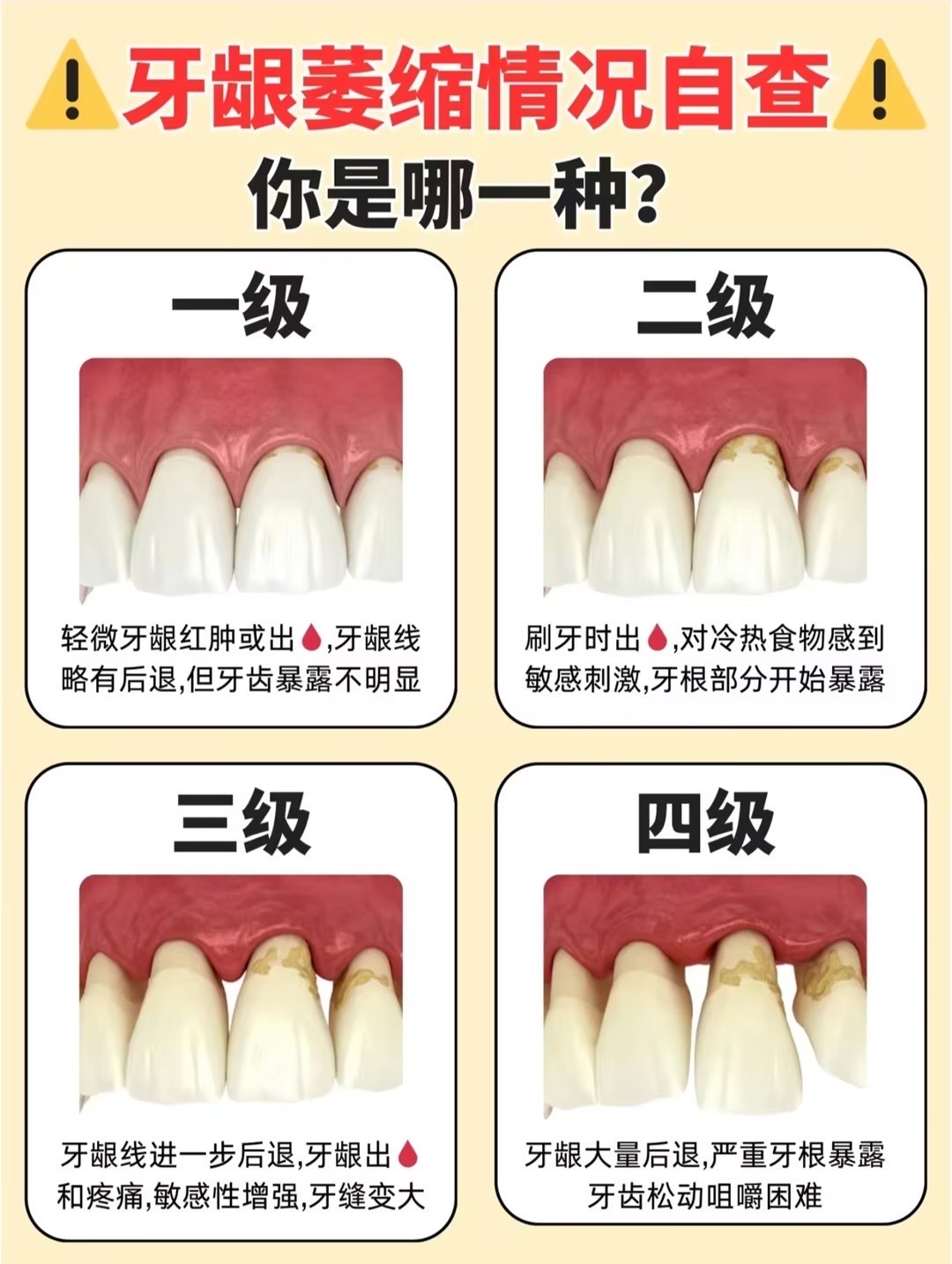 牙龈增生会缩回去吗图片