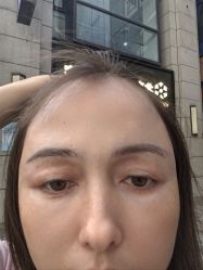 -More摩尔医美の注射线雕光电中心