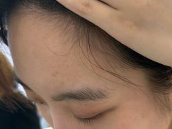 -长沙雅美医疗美容医院