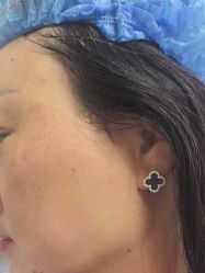 体验后-四川米兰柏羽医学美容医院