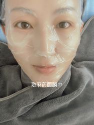 体验前-More摩尔医美の注射线雕光电中心