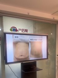 -产后帮产后修复(首城国际店)