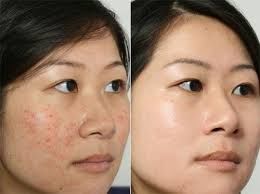 -SKINIST丽铂医疗美容