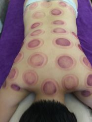-悦艾堂·中医拔罐减肥·美体艾灸连锁