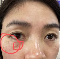 体验前-美莱医学美容医院