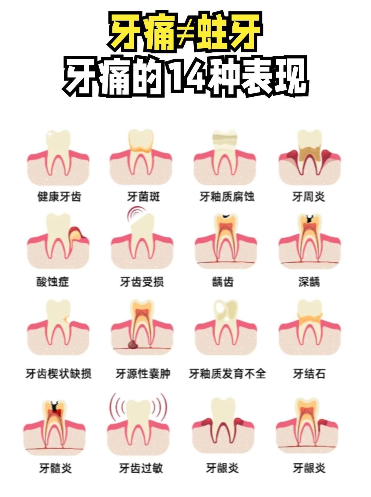 n了解这些表现,不仅能帮助我们及时发现口腔问题,还能有效预防