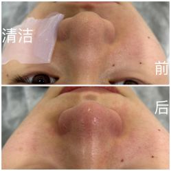 -skin79皮肤管理中心