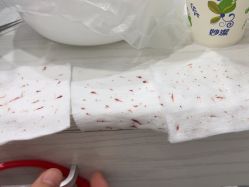 体验后-苗方清颜专业祛痘·皮肤管理