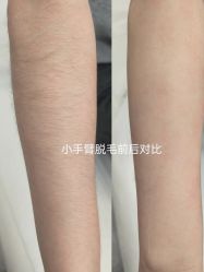 -杭州米兰柏羽医疗美容医院