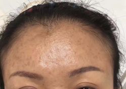 点击看大图 -SKIN79皮肤管理中心
