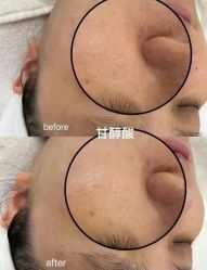 点击看大图 -栖SPA·ONDA ·海菲秀·皑皑科技美肤中心