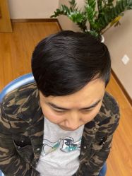 体验后-大麦微针植发全国连锁