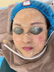 体验前-禾丽康美医疗美容医院