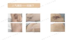 -HEYAN荷妍专业脱毛连锁机构