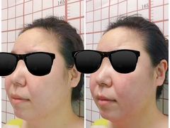 -修申骨雕小颜脊柱骨盆管理产后修复