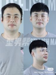 -型男帮男士假发补发·佩戴式发型