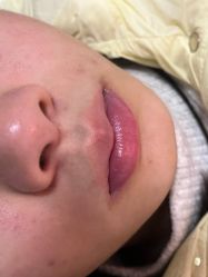 -薇兰专业脱毛连锁机构