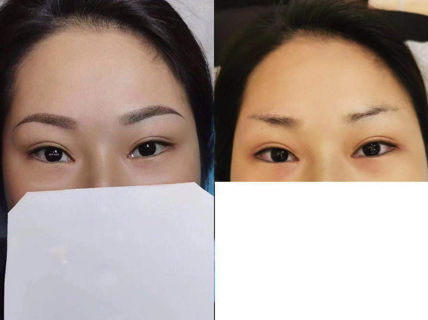 图一:做的是海藻眉 没有结痂期,前后对比