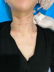 -海涛医疗美容·面部抗衰·注射美鼻