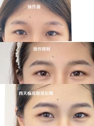 -杨益美学·野生眉半永久纹眉发际线