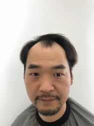 -发饰美男士增发补发假发定制店