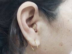 -自然之声助听器·呼吸机(兰考店)