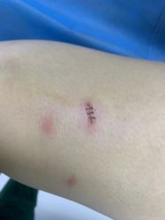 -丽美妍医疗美容·皮秒·立体分层抗衰