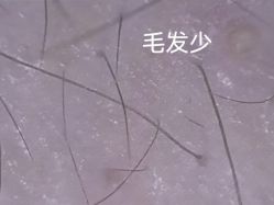 -北京雍禾植发医院
