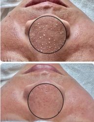 -美肤盾祛痘·问题肌头疗管理中心