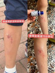 -安吉拉青春化管理中心