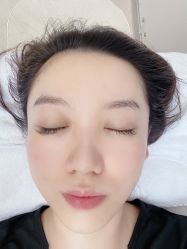 体验后-北京楚诺医疗美容