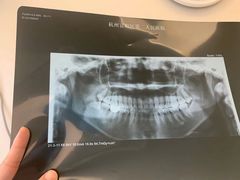 -宁波口腔医院(鄞州分院)