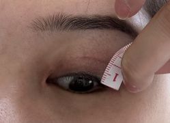 体验后-成都艾特他整形外科医院