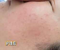 -SKINLALA美肤疗愈SPA