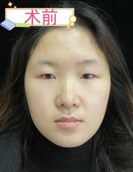 -素美医疗美容·西南眼鼻整形·修复基地