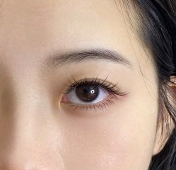 -宥莉·ULLY 痘敏肌•科技皮肤管理中心